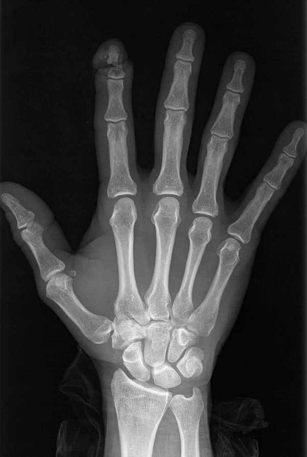 Figure 7.tif