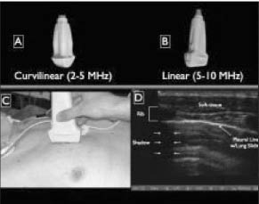 penetrating trauma fig 3_0001.jpg