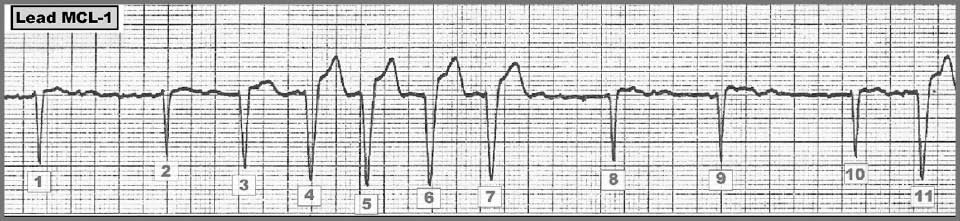 ECG Review 246-Grey.jpeg