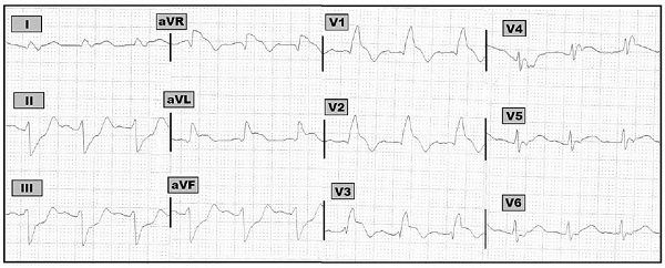 ECG 247-Grey.jpeg