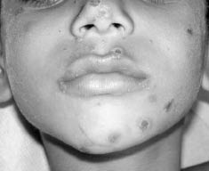 Figure 7a face.jpg