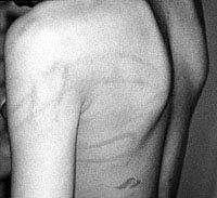 PDMR0712 fig 2 loop marks.jpg