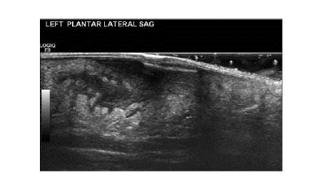 PDMR0813RAfig3opt.jpg