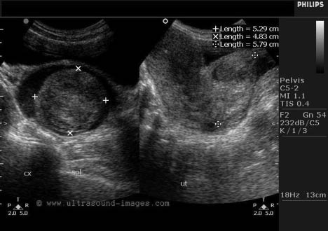EMR042511fig2.jpg