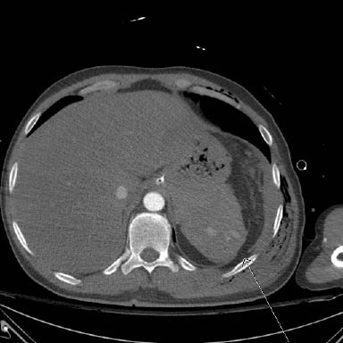 Figure 6 - Diaphrgam.jpg