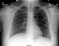 EMR080111fig1B.pdf