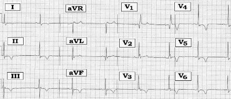 ECG Rev-#230.tif
