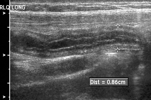 PDMR1111fig1AppyUS.TIF