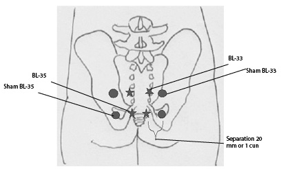 Figure 1 acupuncture points