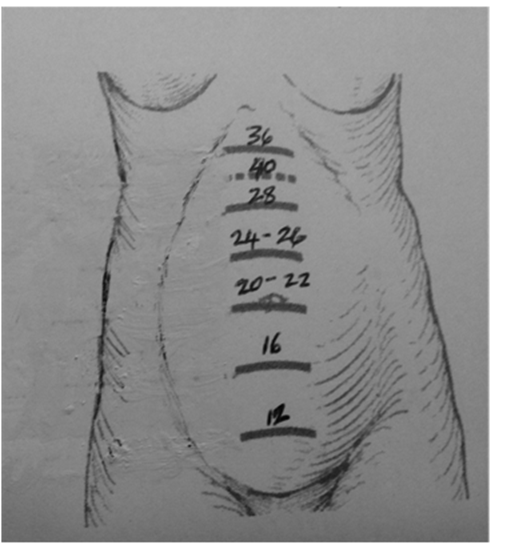 Approximate Gestational Age Based on Fundal Height