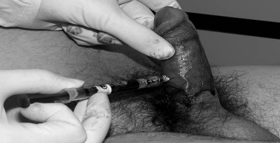 treatment