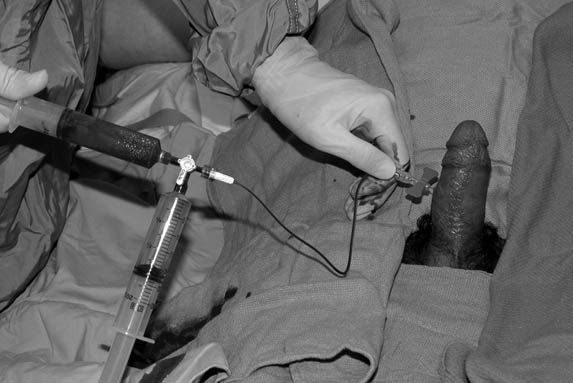 treatment