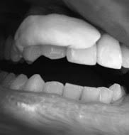 Periodontal dressing