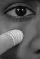 Infraorbital 2