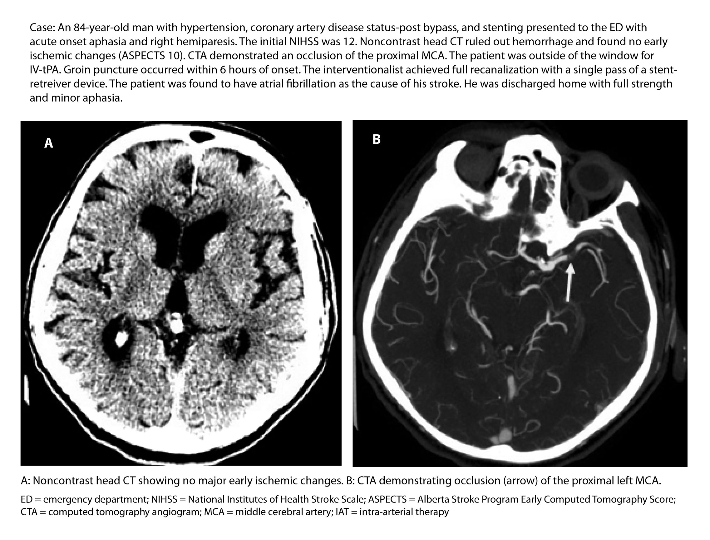 neurovascular imaging