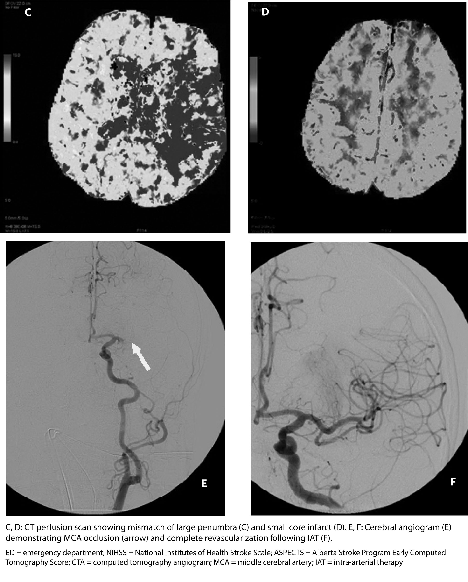 figure 2b