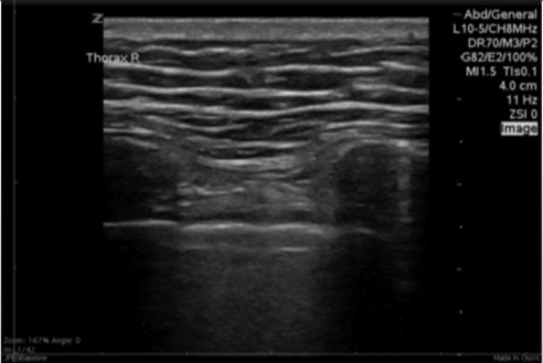 Thoracic view