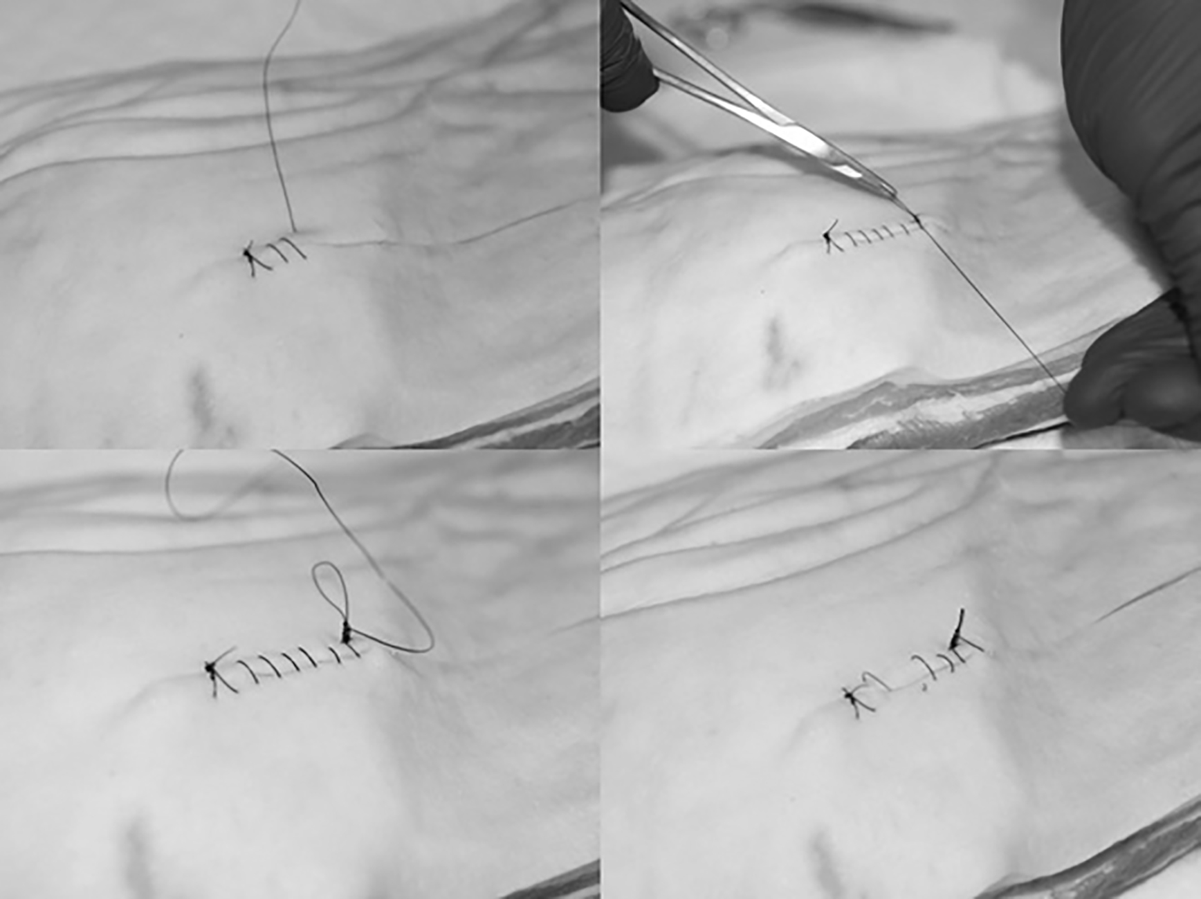 Running sutures
