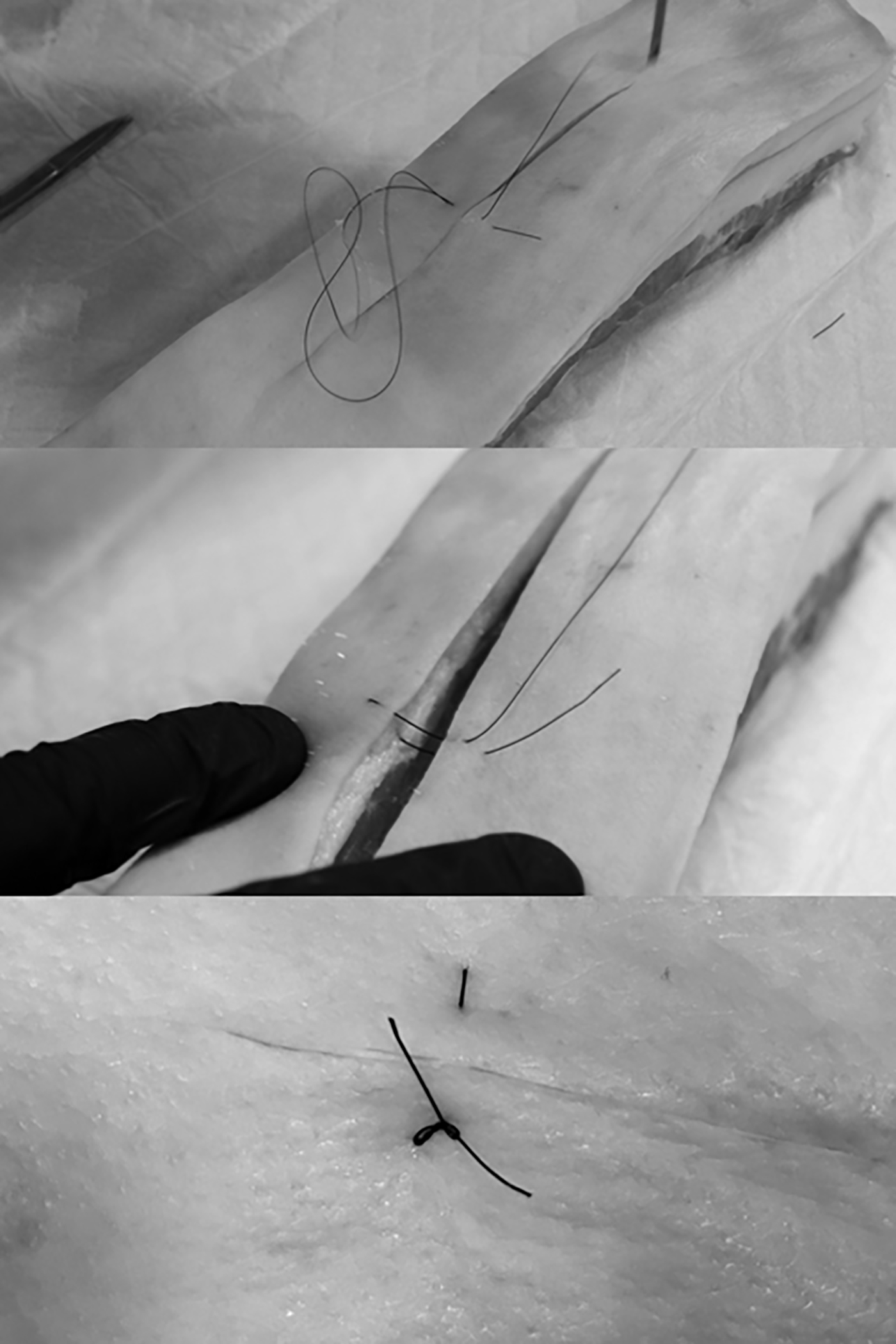 Vertical mattress sutures