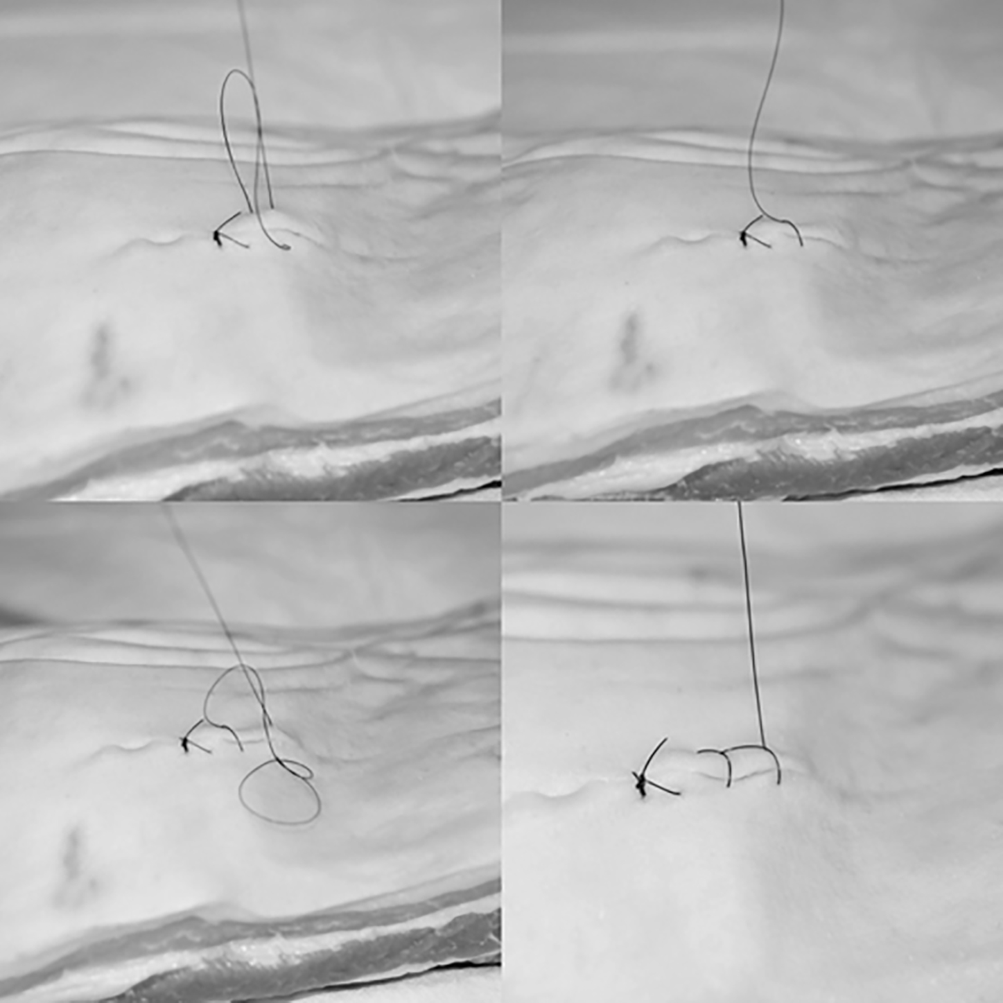 Placement of locked running sutures