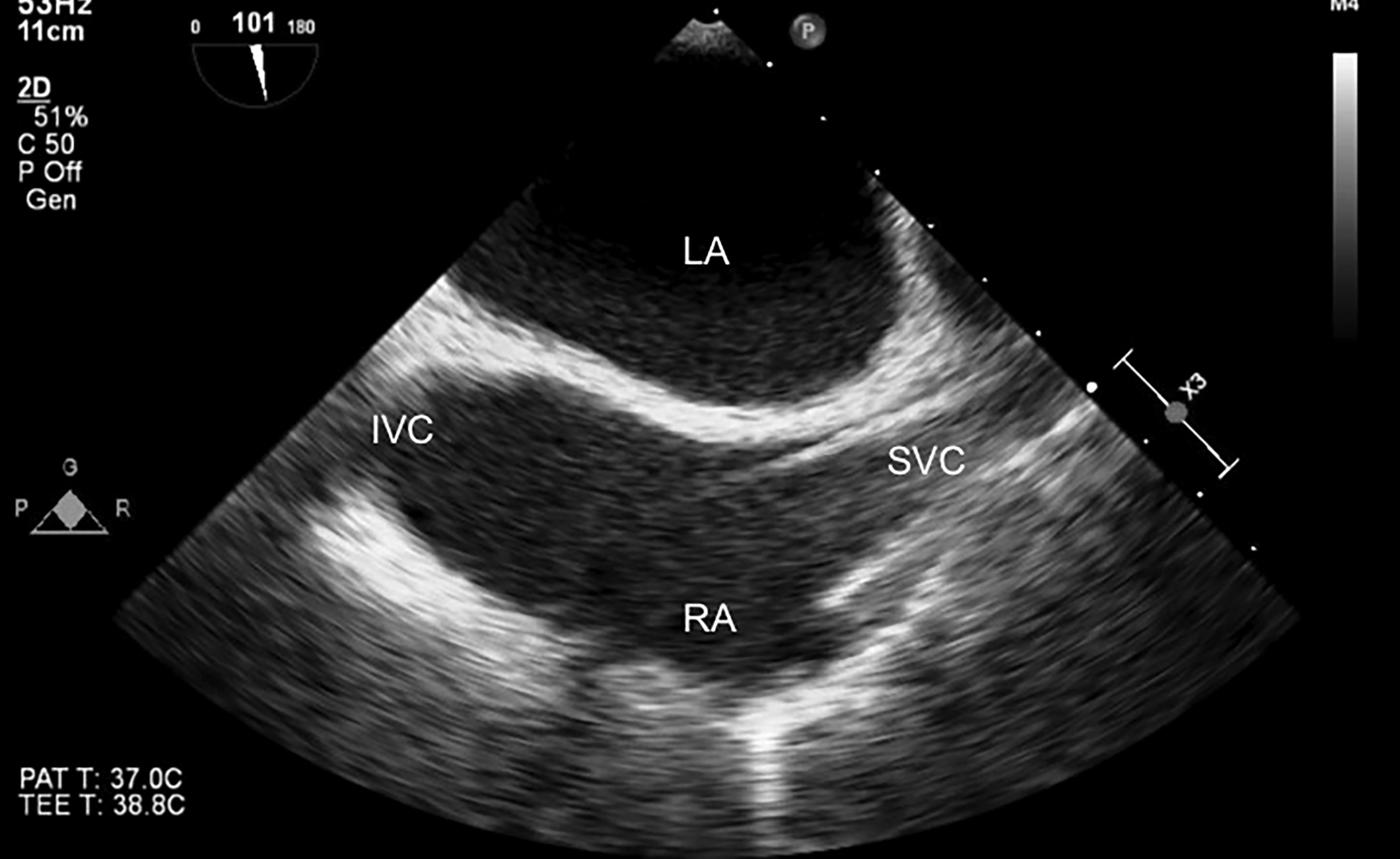 Figure 11