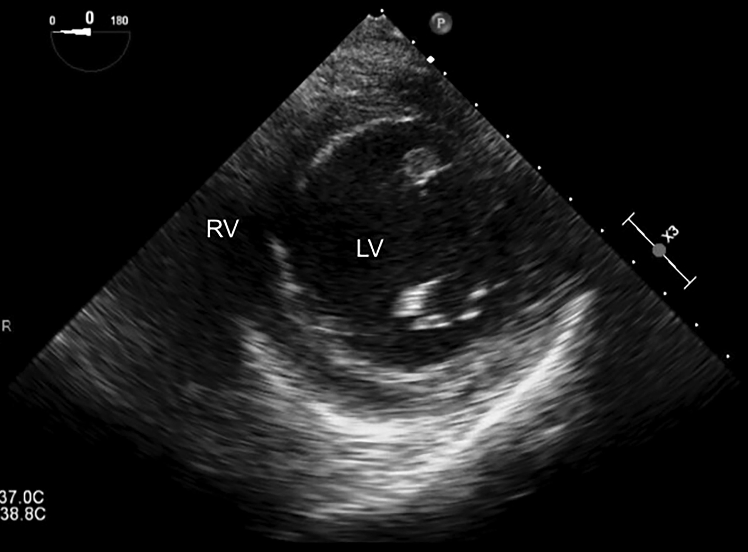 Figure 12
