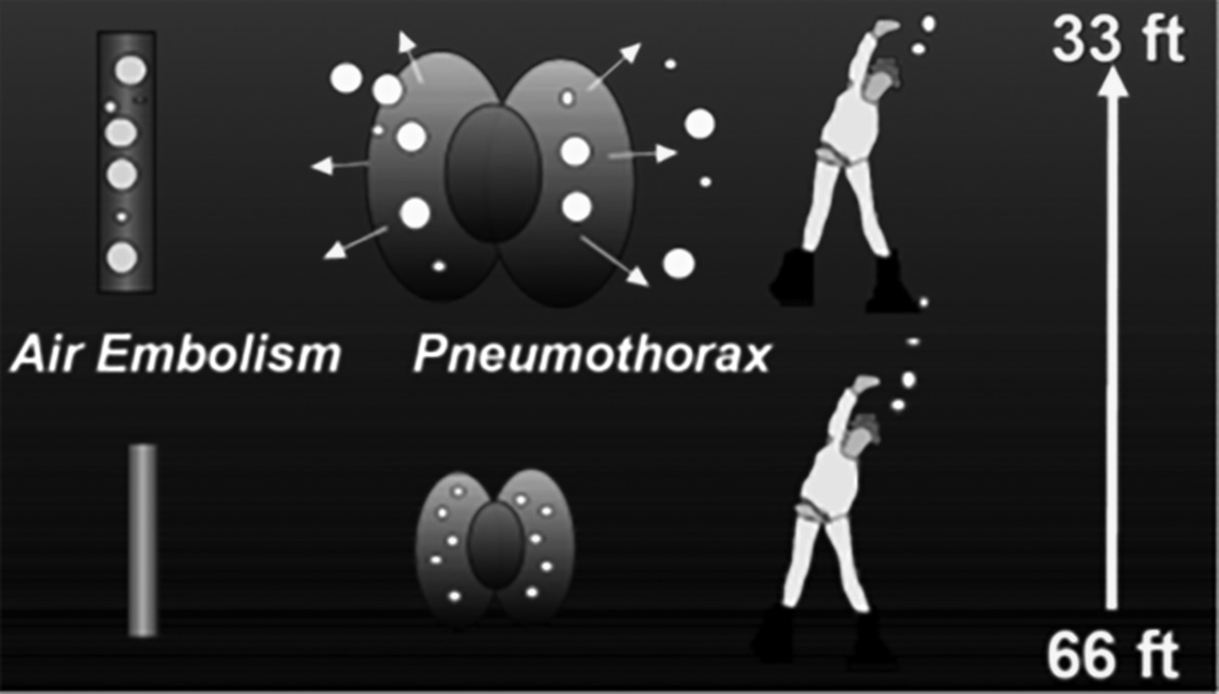 Air embolism in ascending diver
