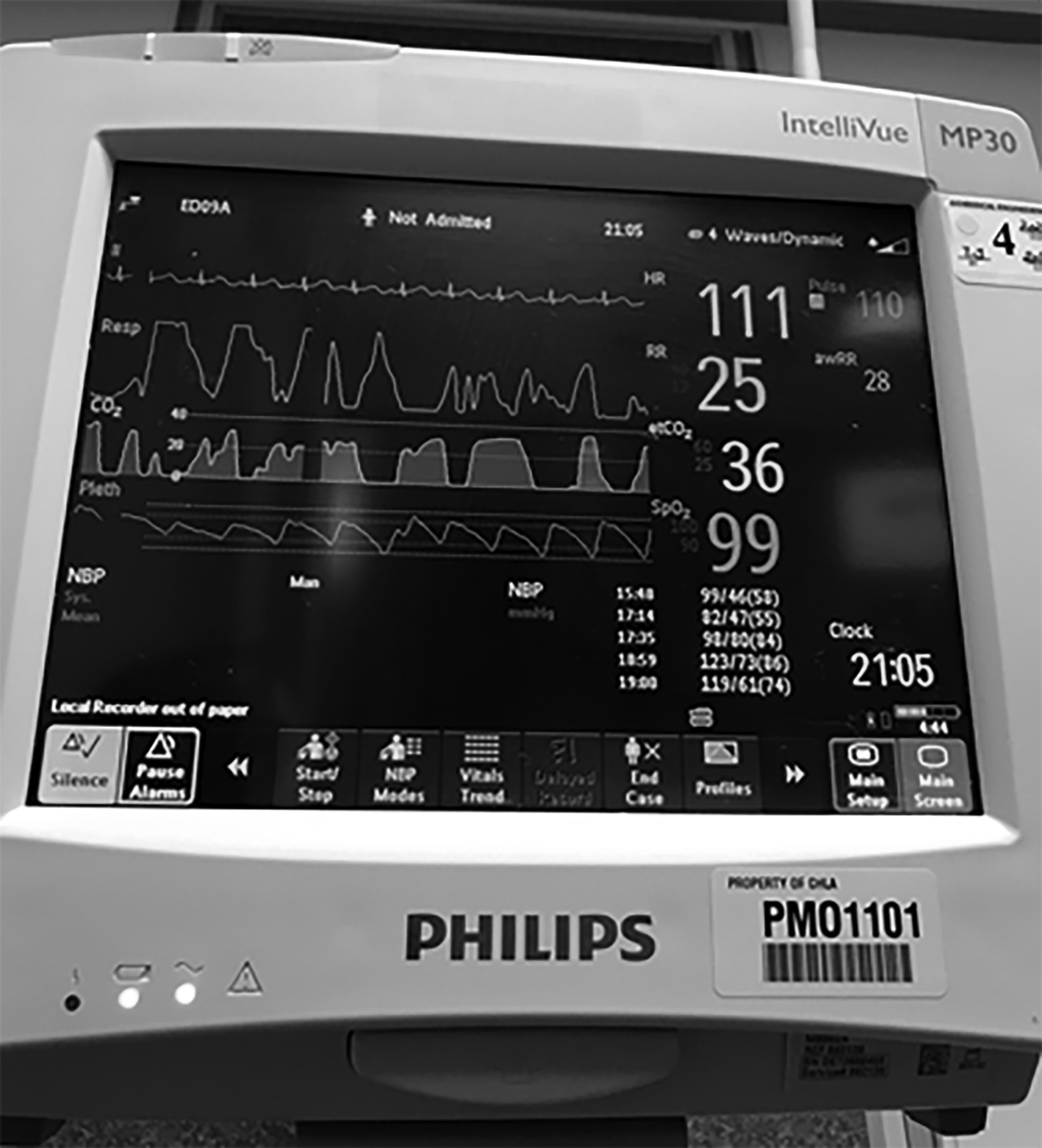 Monitoring