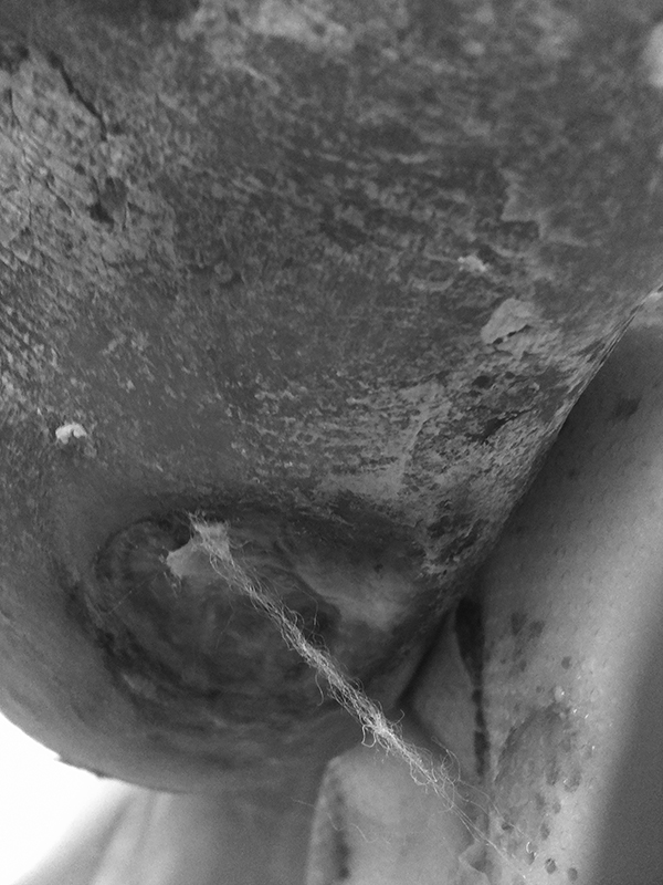 Dry gauze attached to wound