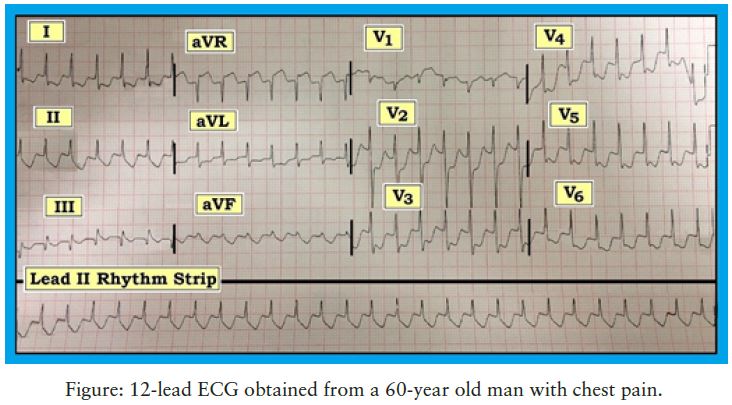 Figure 12