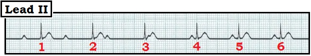 ECG Review 0615