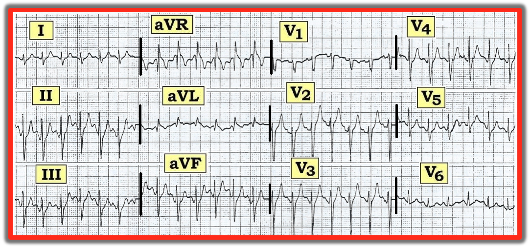 ECG Review 071515