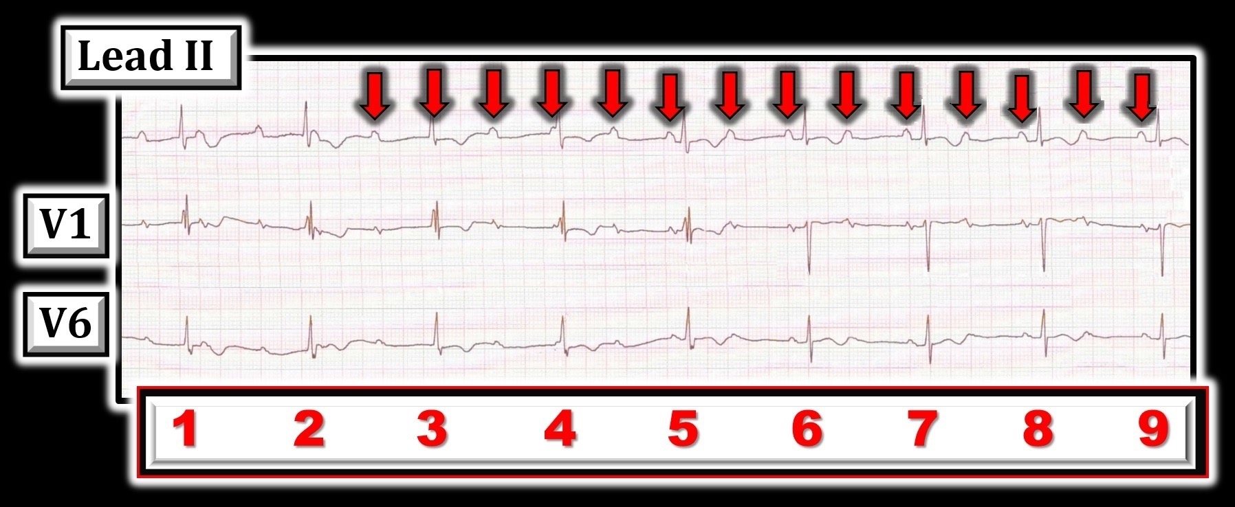 ECG Review