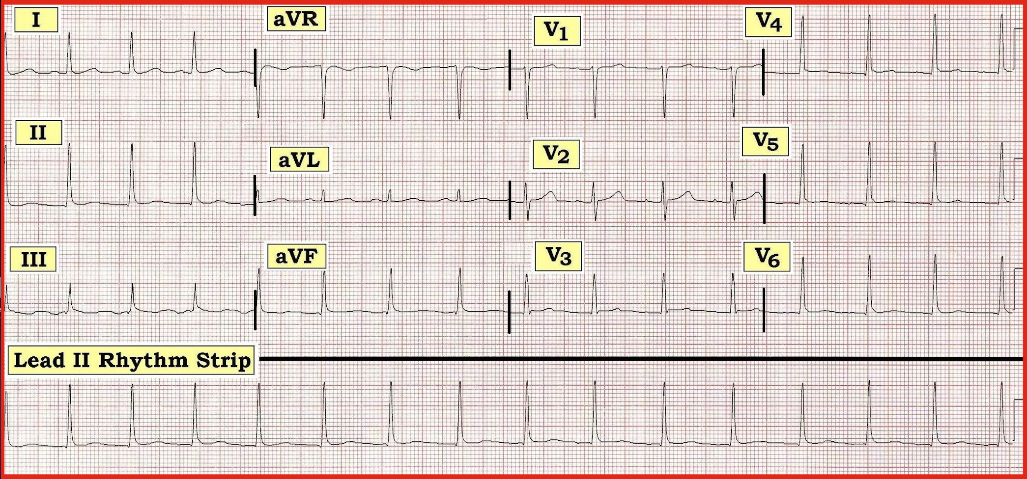 ECG Review