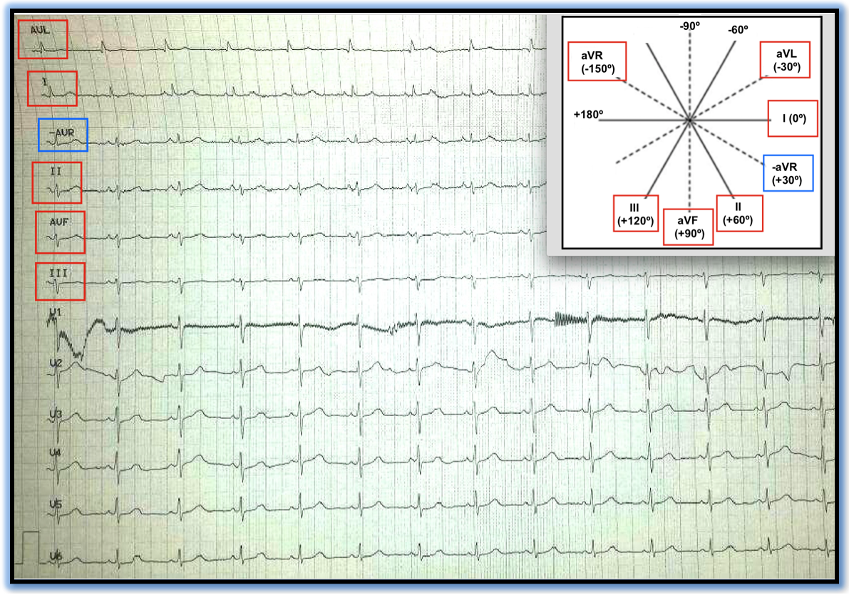 ECG Review 292