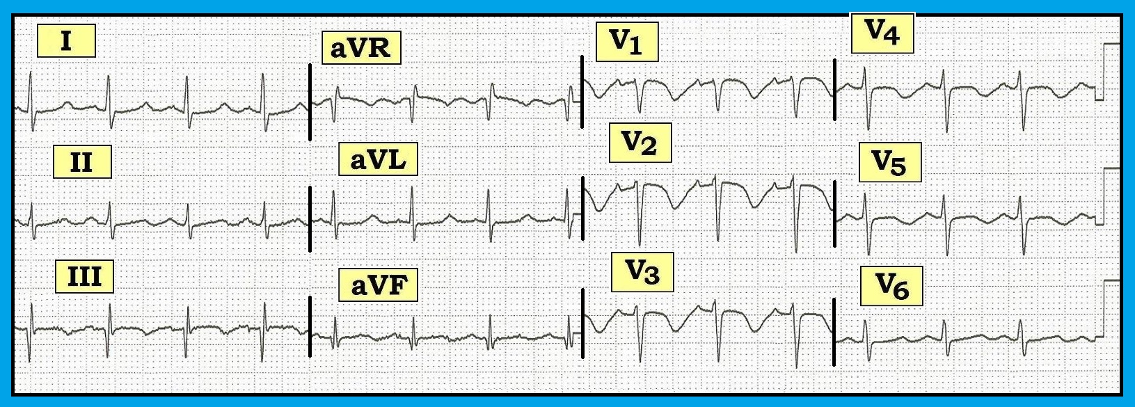 ECG Review 295