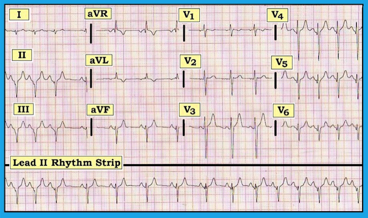 ECG Review