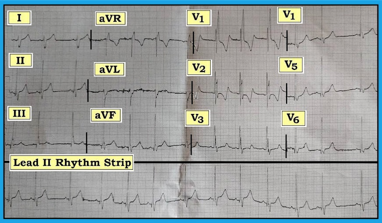 ECG Review