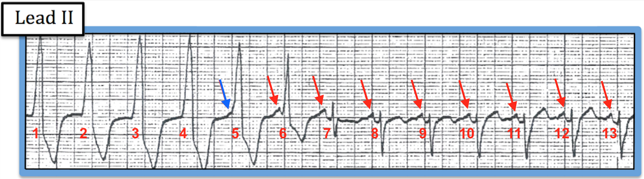 ECG Review