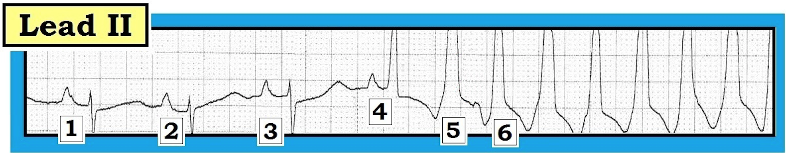ECG Review