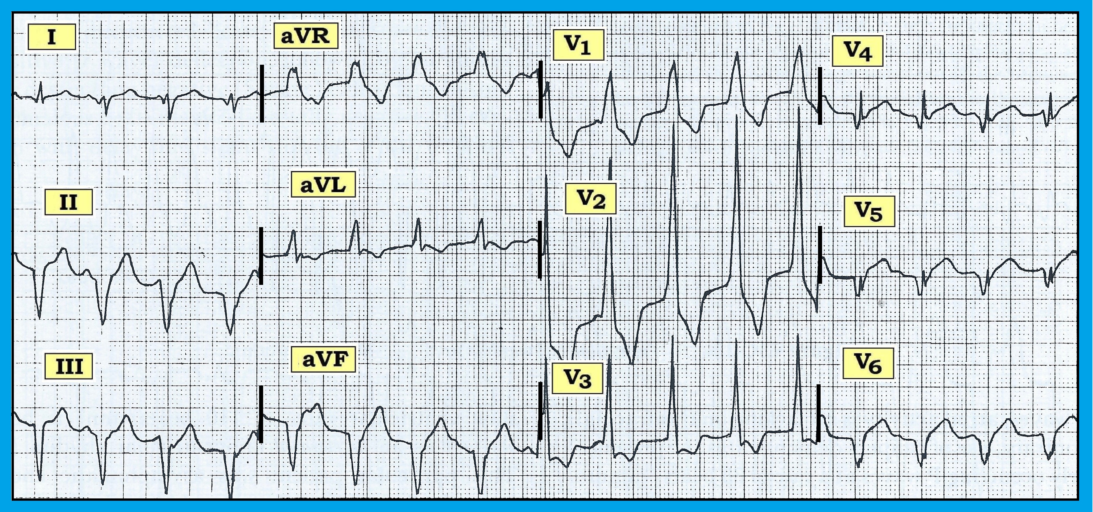 ECG Review