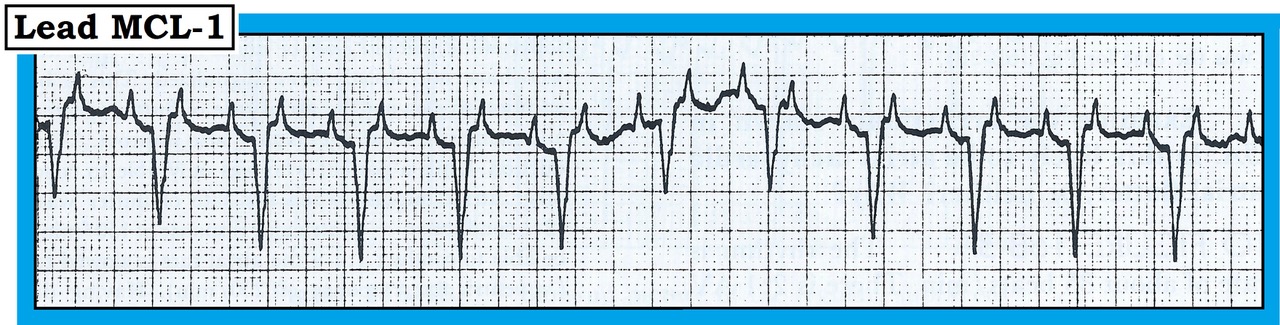 ECG Review