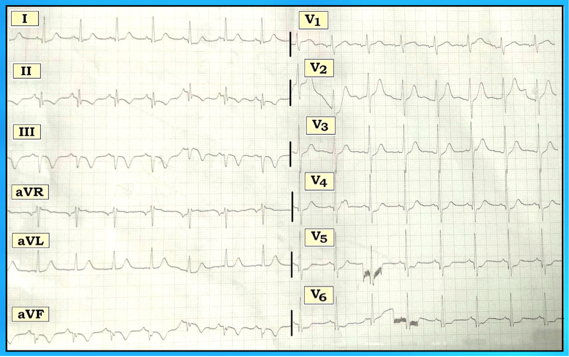 ECG Review