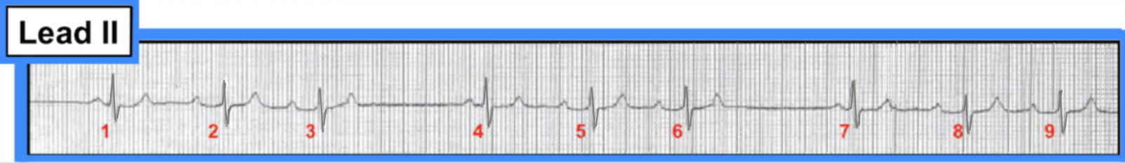 ECG Review