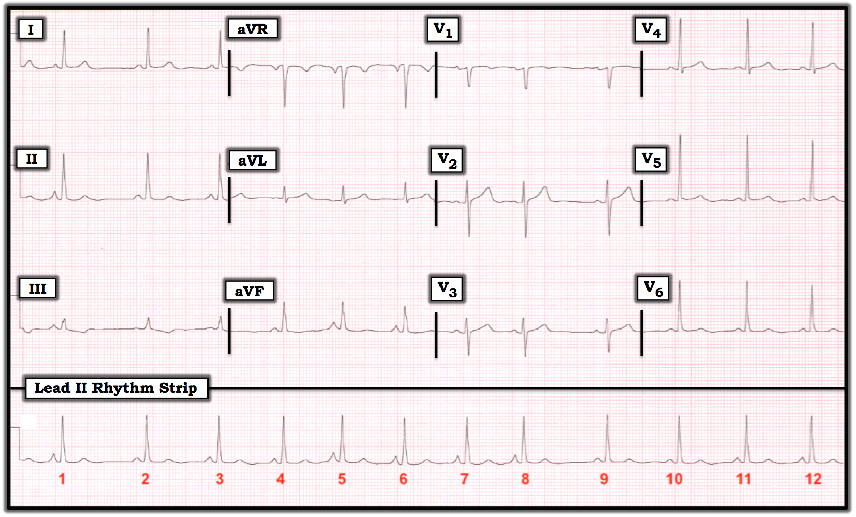 ECG Review