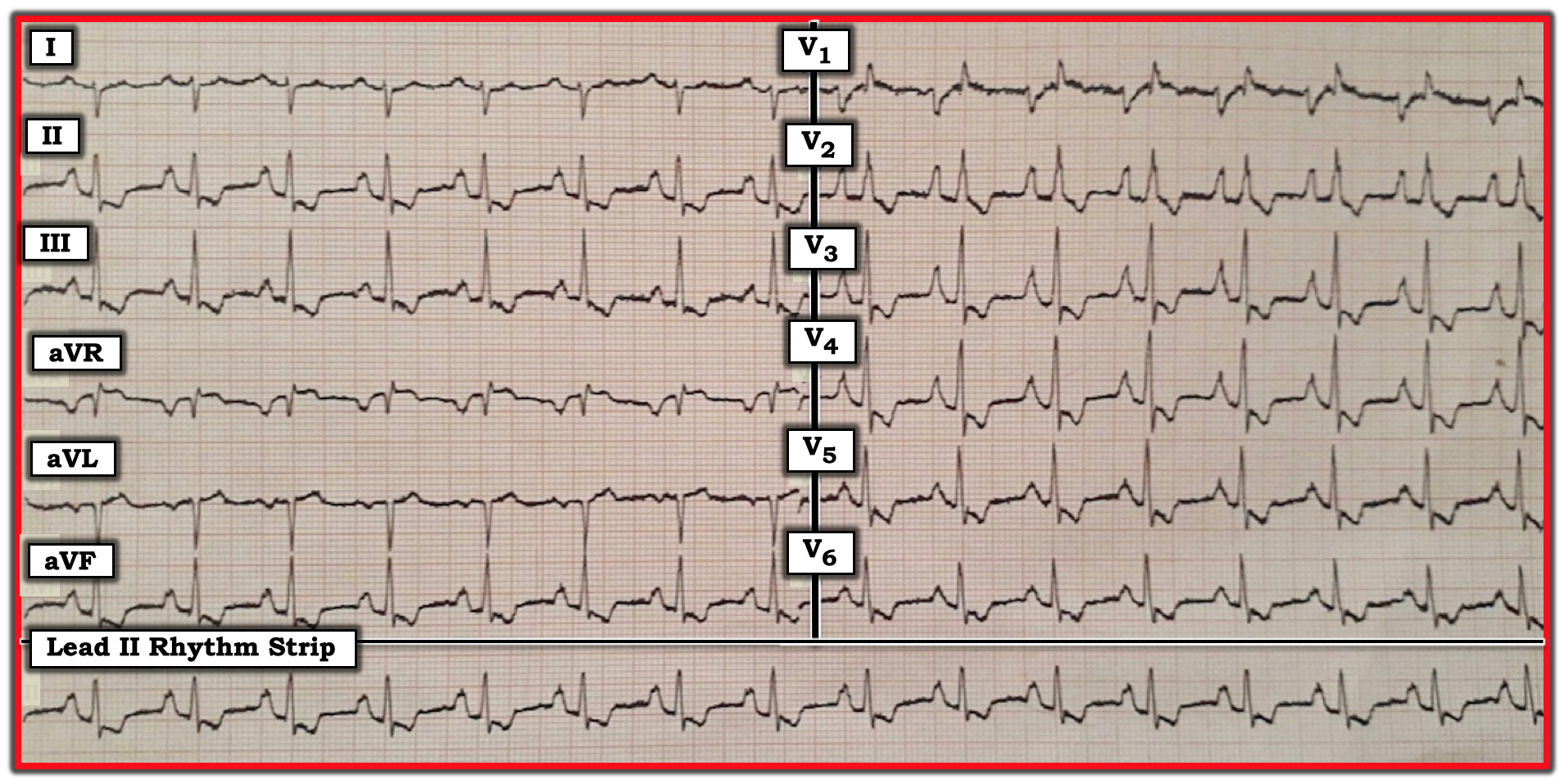 ECG Review