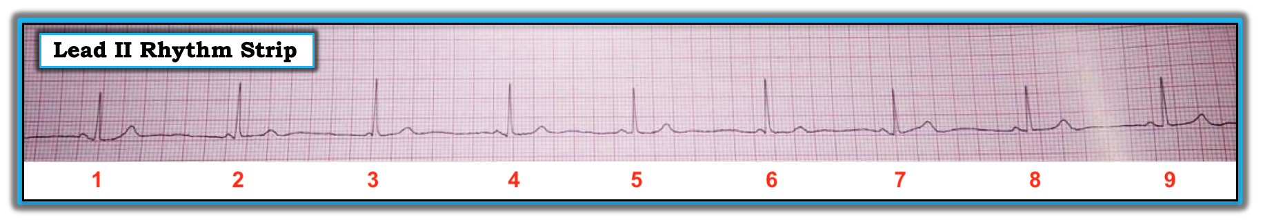 ECG Review