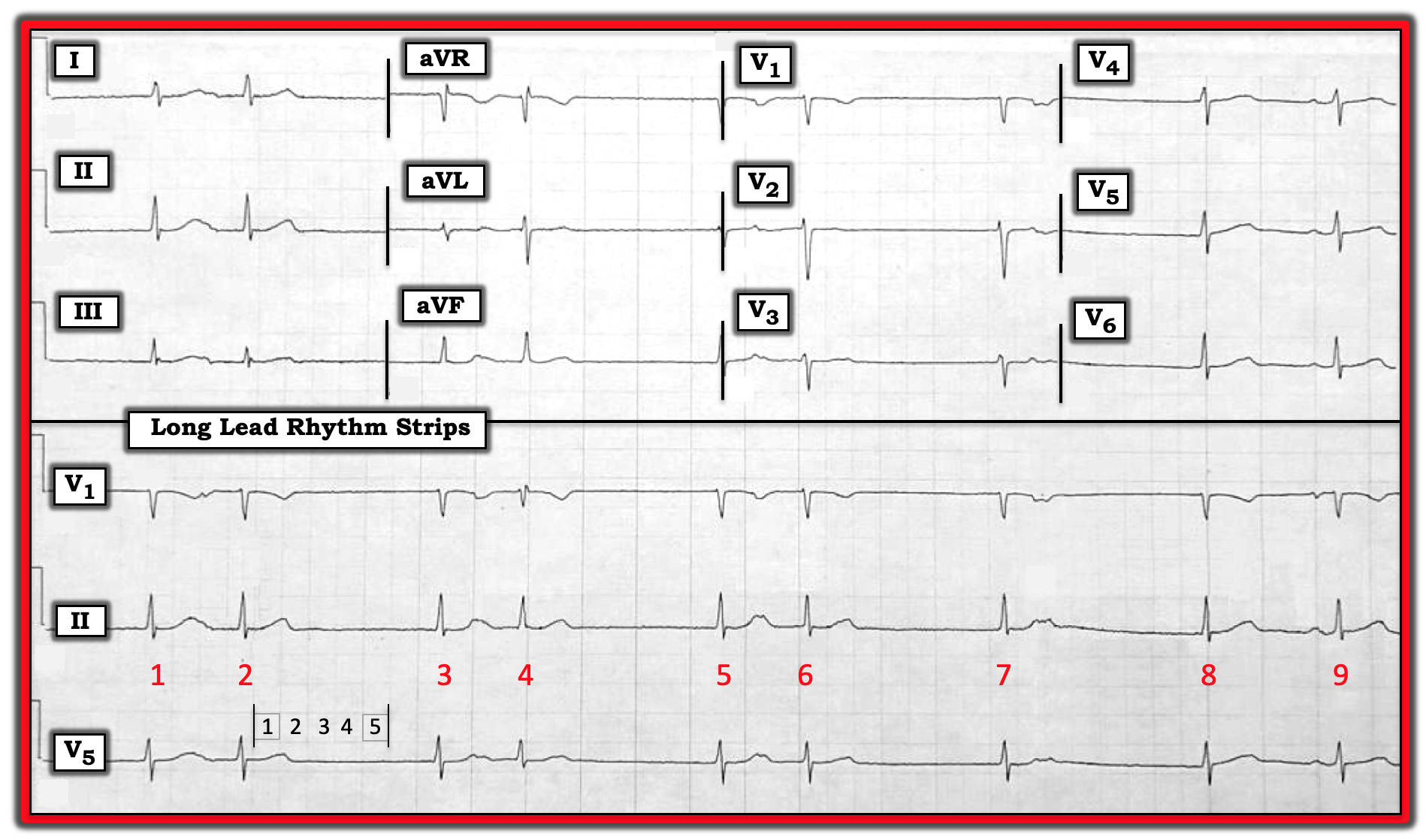 ECG Review