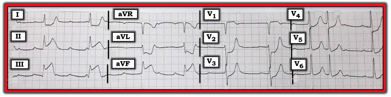 ECG Review