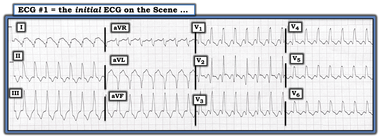 ECG Review